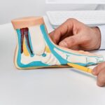 An orthopedic surgery expert witness demonstrating something on a model ankle