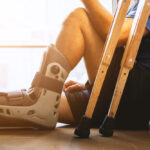 Foot and ankle injury expert witness providing litigation support