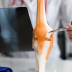Expert witness in rheumatology and musculoskeletal disorders