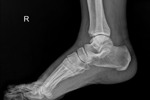 Foot and Ankle Expert Witness, Orthopedic Expert Witness, Expert Testimony, Foot and Ankle Injury Expert