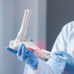 Orthopedic Expert Witness Dr. Mark Conklin offering foot and ankle injury expert testimony and litigation support.