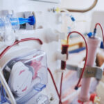 Hemodialysis machine used in renal failure cases in Bethesda, MD