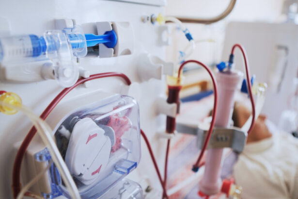 Hemodialysis machine used in renal failure cases in Bethesda, MD