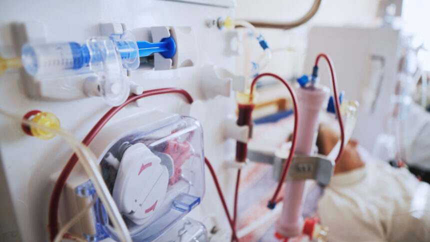 Hemodialysis machine used in renal failure cases in Bethesda, MD